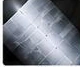 Radiography Testing